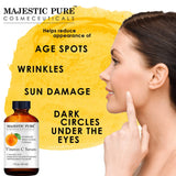 MAJESTIC PURE Vitamin C Serum for Face - Topical Antioxidant Facial Serum with L - ascorbic Acid - Promotes Natural Skin Care and Anti Aging - Fights Acne, Age Spots and HyperPigmentation - 1 fl. oz